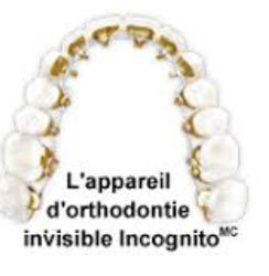 CDM  Cabinet dentaire - Orthondontie radiologie - l'appareil d'Orthodontie invisible incognito